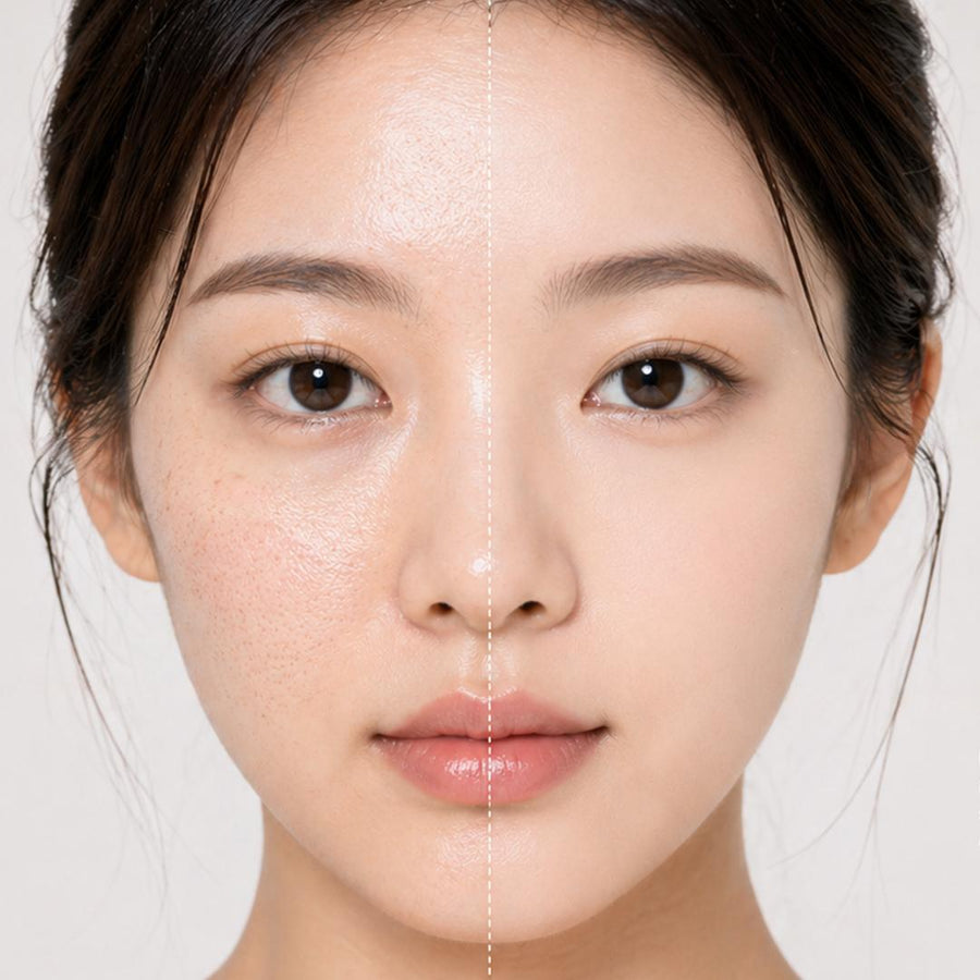 OIL CONTROL & PORES
